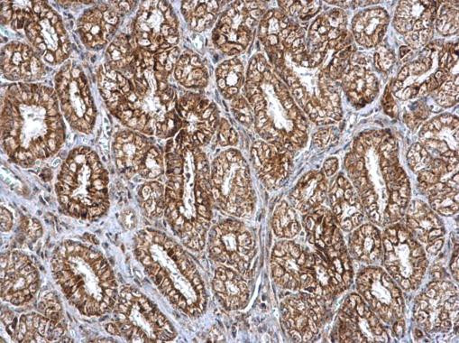 SMPD4 Antibody in Immunohistochemistry (Paraffin) (IHC (P))