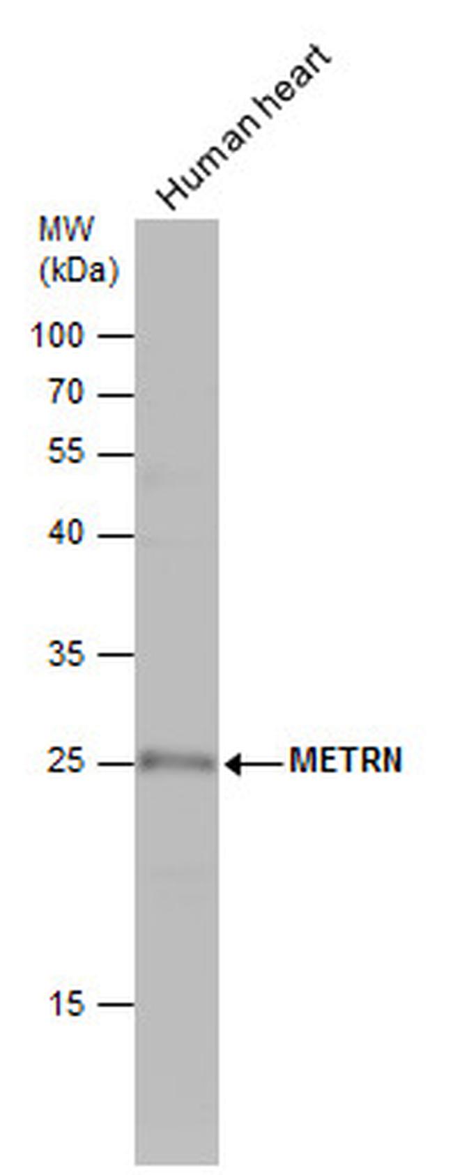 Meteorin Antibody in Western Blot (WB)