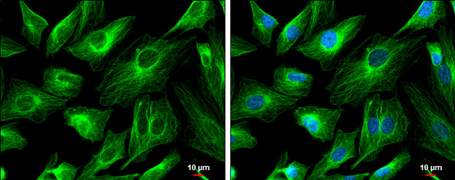 FSD1 Antibody in Immunocytochemistry (ICC/IF)