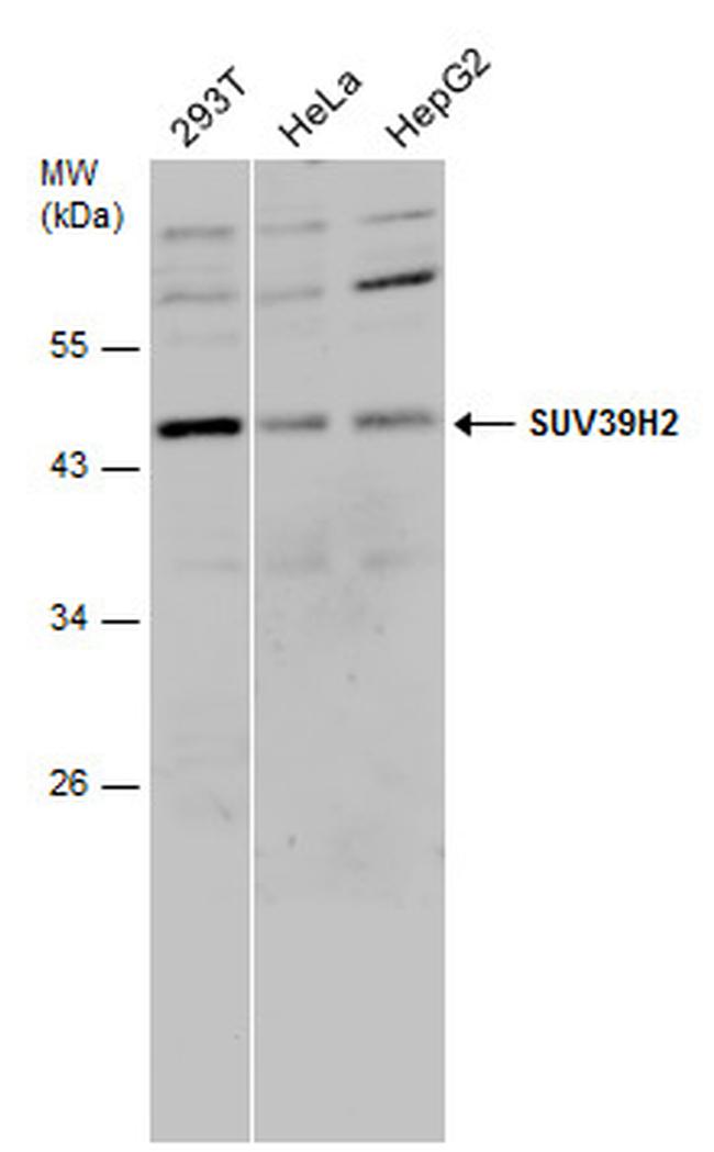 SUV39H2 Antibody in Western Blot (WB)