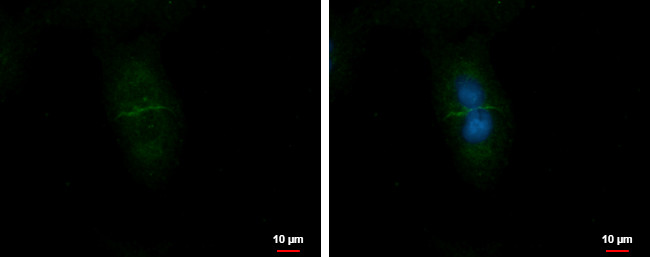 CD99L2 Antibody in Immunocytochemistry (ICC/IF)