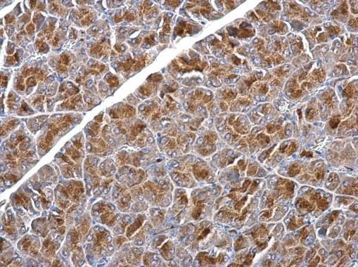 SNX25 Antibody in Immunohistochemistry (Paraffin) (IHC (P))