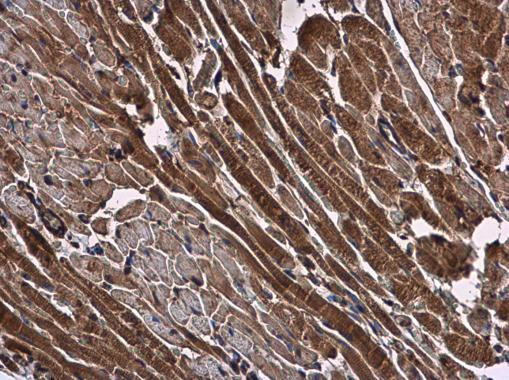 NMD3 Antibody in Immunohistochemistry (Paraffin) (IHC (P))