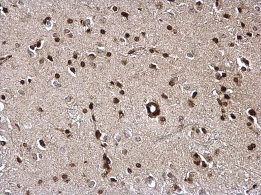 PELO Antibody in Immunohistochemistry (Paraffin) (IHC (P))