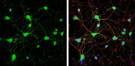 mGluR5 Antibody in Immunocytochemistry (ICC/IF)