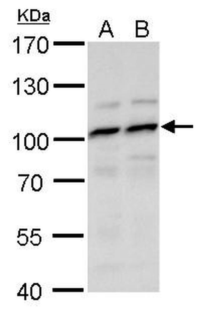 MYSM1 Antibody in Western Blot (WB)