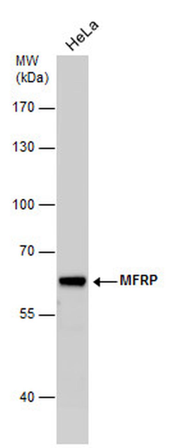 MFRP Antibody in Western Blot (WB)