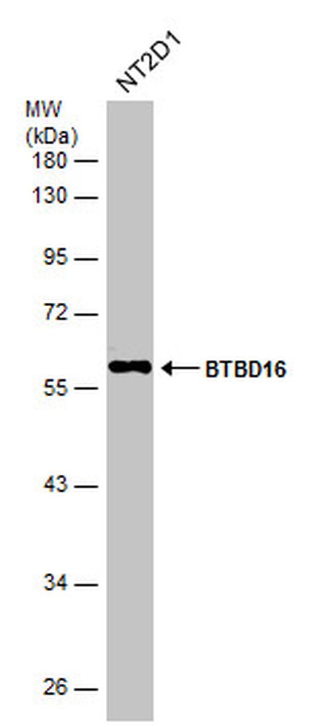 BTBD16 Antibody in Western Blot (WB)