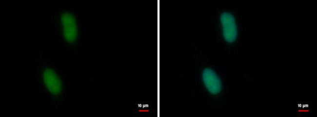 CDYL2 Antibody in Immunocytochemistry (ICC/IF)
