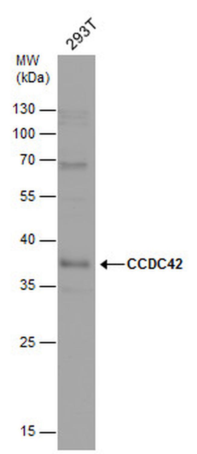 CCDC42 Antibody in Western Blot (WB)