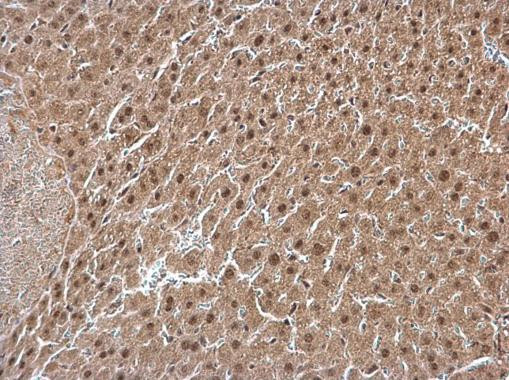 GPS1 Antibody in Immunohistochemistry (Paraffin) (IHC (P))