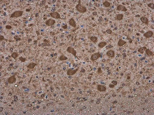 MARS Antibody in Immunohistochemistry (Paraffin) (IHC (P))