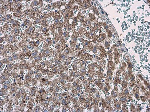ABAT Antibody in Immunohistochemistry (Paraffin) (IHC (P))
