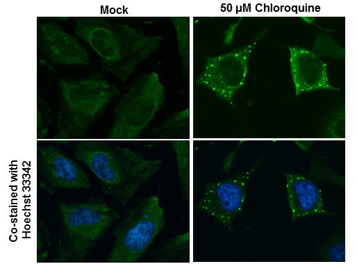 ATG9B Antibody in Immunocytochemistry (ICC/IF)