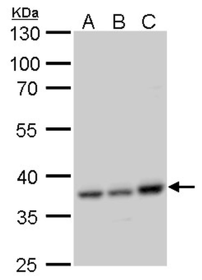 CCDC137 Antibody in Western Blot (WB)