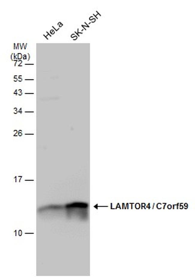 LAMTOR4 Antibody in Western Blot (WB)
