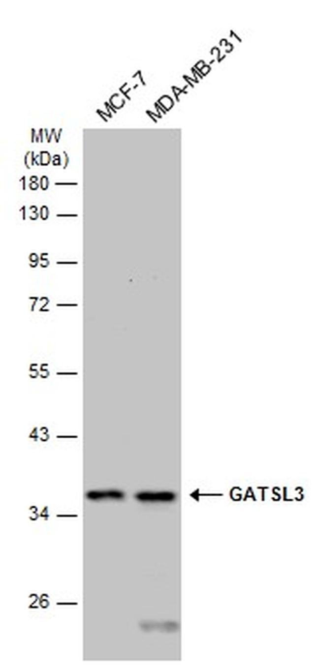 GATSL3 Antibody in Western Blot (WB)