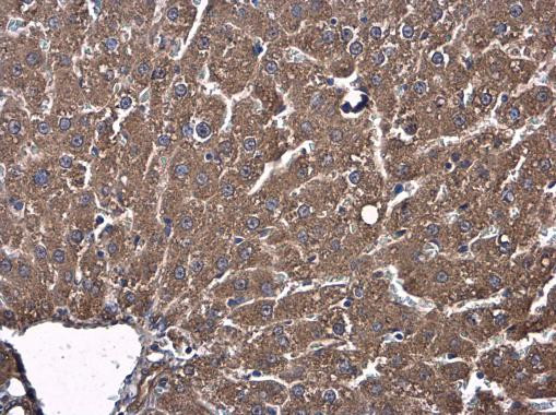 AJAP1 Antibody in Immunohistochemistry (Paraffin) (IHC (P))