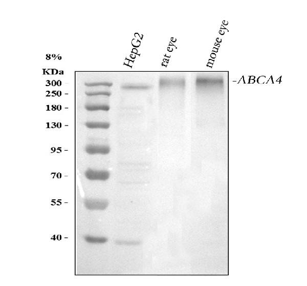 ABCA4 Antibody in Western Blot (WB)