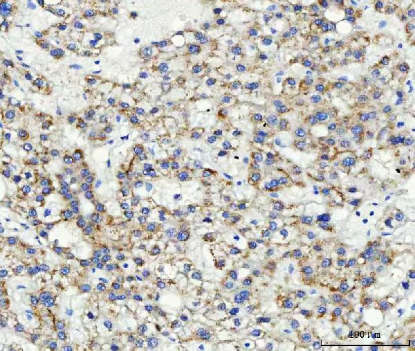 ABCB4 Antibody in Immunohistochemistry (Paraffin) (IHC (P))