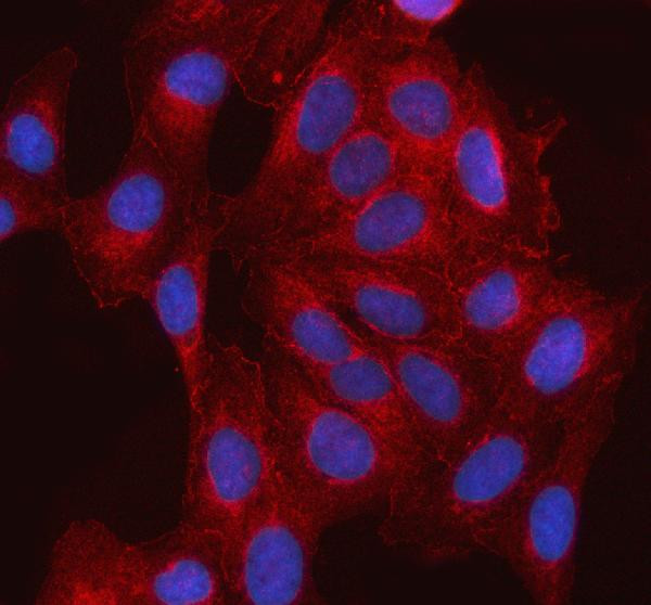 ABI1 Antibody in Immunocytochemistry (ICC/IF)