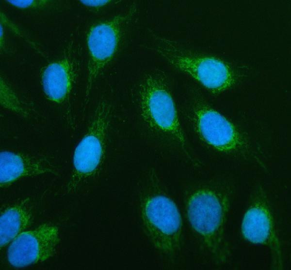 ACADVL Antibody in Immunocytochemistry (ICC/IF)