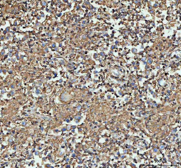 ACTA1 Antibody in Immunohistochemistry (Paraffin) (IHC (P))