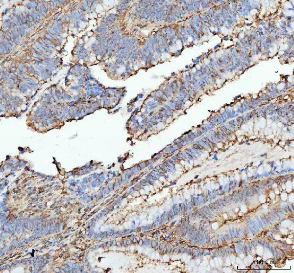 ACTA1 Antibody in Immunohistochemistry (Paraffin) (IHC (P))