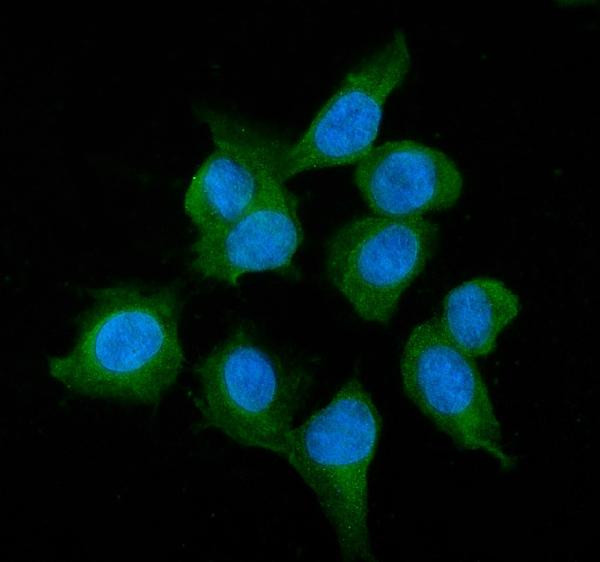 Alcohol Dehydrogenase 1A Antibody in Immunocytochemistry (ICC/IF)