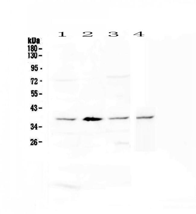 AHA1 Antibody in Western Blot (WB)