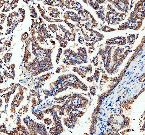 Adenylate Kinase 1 Antibody in Immunohistochemistry (Paraffin) (IHC (P))