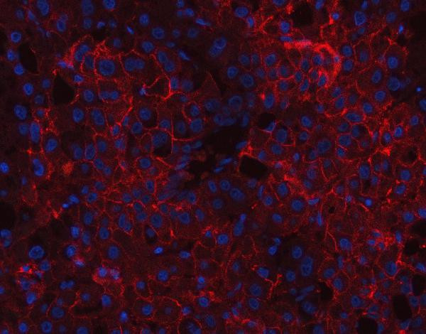CD166 (ALCAM) Antibody in Immunohistochemistry (Paraffin) (IHC (P))