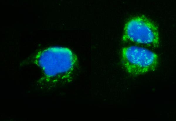 AMHR2 Antibody in Immunocytochemistry (ICC/IF)