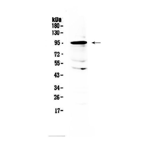 AMOTL2 Antibody in Western Blot (WB)