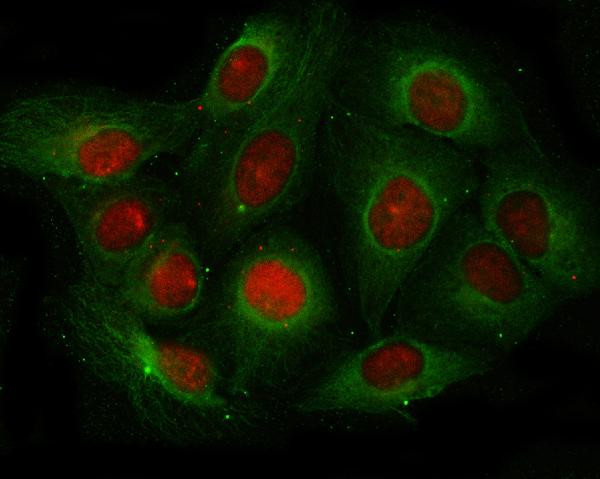 Angiogenin Antibody in Immunocytochemistry (ICC/IF)