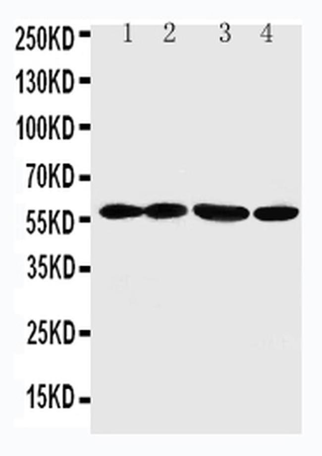 ANGPTL1 Antibody in Western Blot (WB)