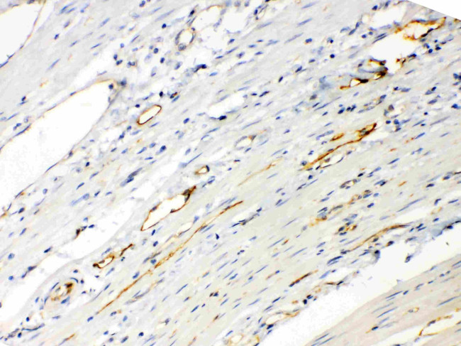 ANGPTL2 Antibody in Immunohistochemistry (Paraffin) (IHC (P))