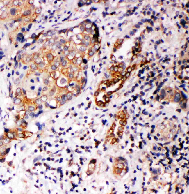 Annexin A10 Antibody in Immunohistochemistry (Paraffin) (IHC (P))
