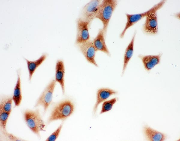 Annexin A3 Antibody in Immunocytochemistry (ICC/IF)