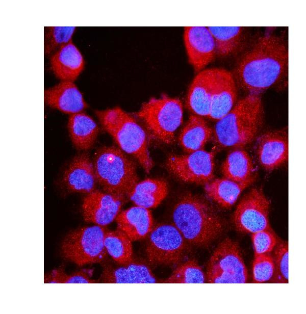 RIAM Antibody in Immunocytochemistry (ICC/IF)