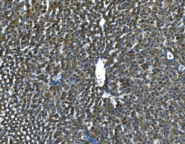 Serum Amyloid P Antibody in Immunohistochemistry (Paraffin) (IHC (P))