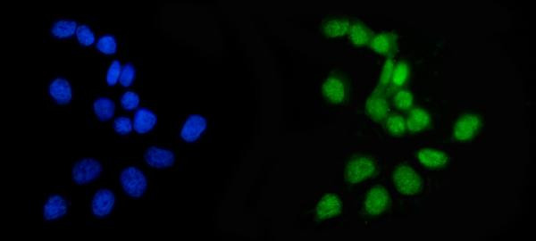 APRT Antibody in Immunocytochemistry (ICC/IF)