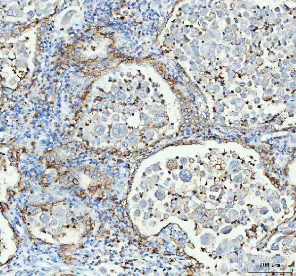 Aquaporin 4 Antibody in Immunohistochemistry (Paraffin) (IHC (P))
