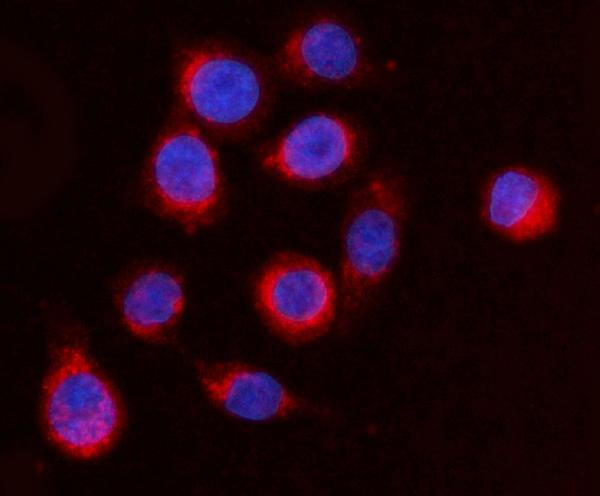 ARFGAP1 Antibody in Immunocytochemistry (ICC/IF)