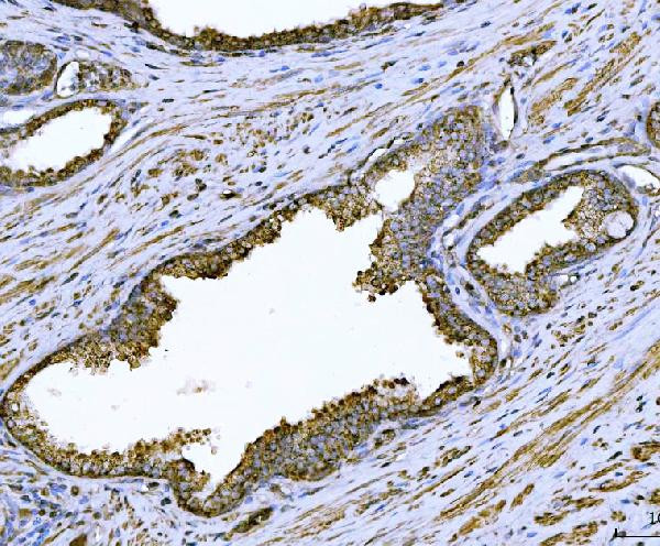 Arginase 2 Antibody in Immunohistochemistry (Paraffin) (IHC (P))