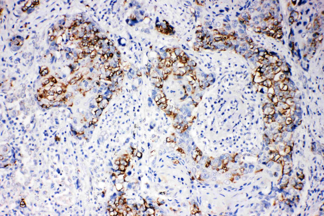 beta Arrestin 1 Antibody in Immunohistochemistry (Paraffin) (IHC (P))