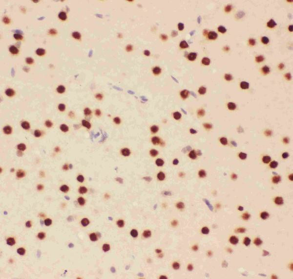 ATF2 Antibody in Immunohistochemistry (Paraffin) (IHC (P))