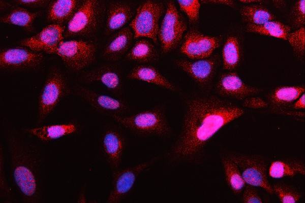 ATG14 Antibody in Immunocytochemistry (ICC/IF)