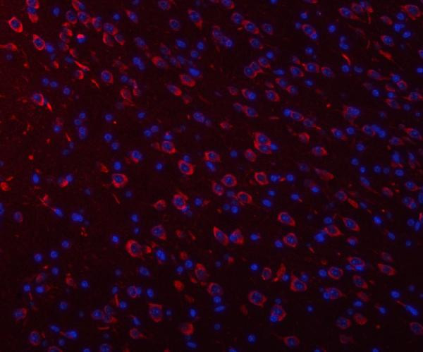 Ataxin 2 Antibody in Immunohistochemistry (Paraffin) (IHC (P))