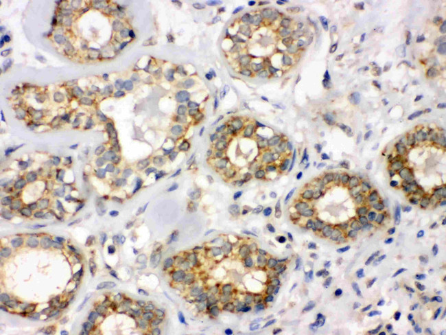 B3GNT8 Antibody in Immunohistochemistry (Paraffin) (IHC (P))